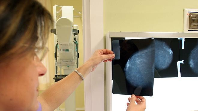Una nueva terapia aumenta un 35% la supervivencia del cáncer de mama